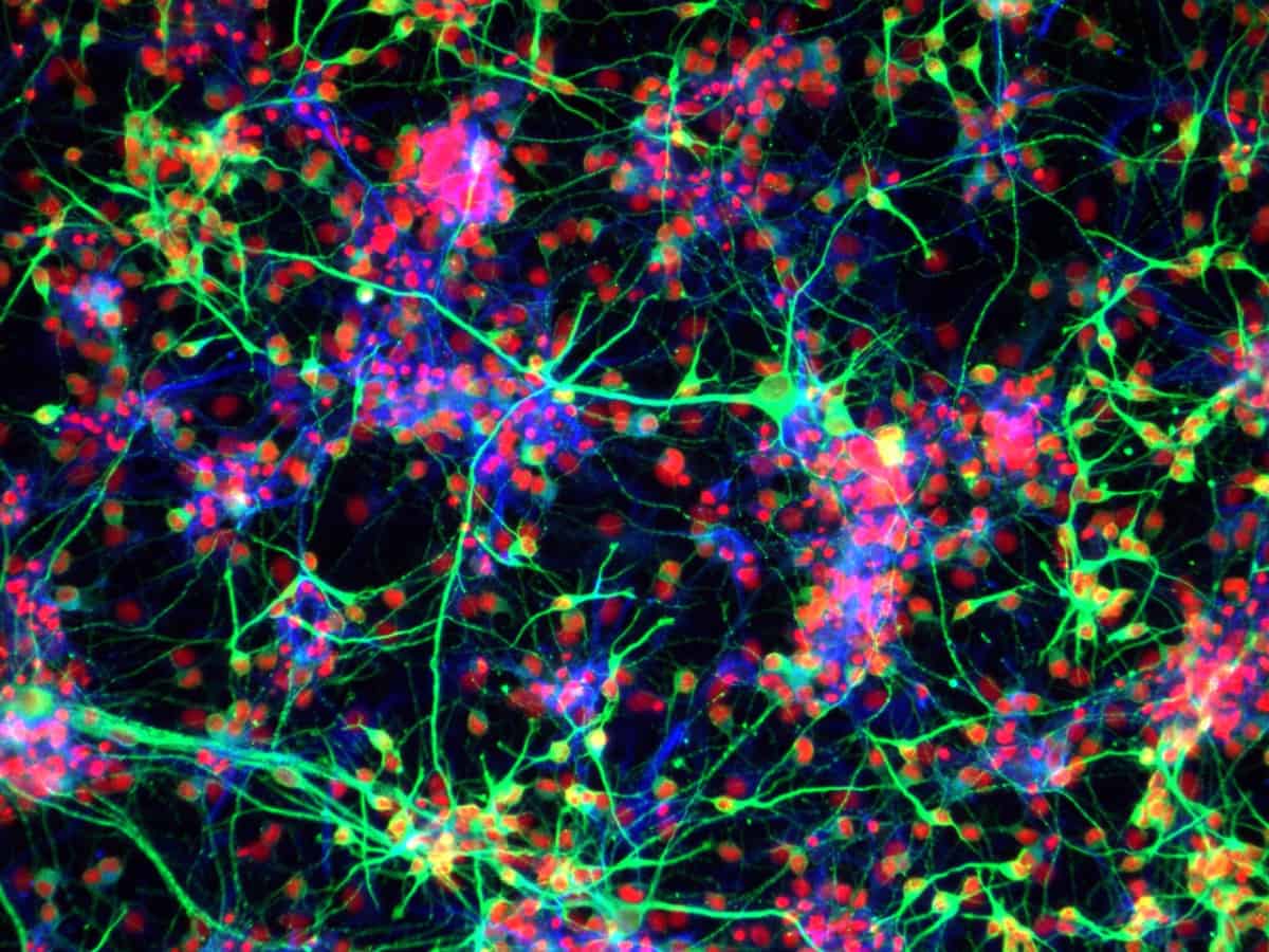 Il gene che controlla il destino delle cellule staminali neurali