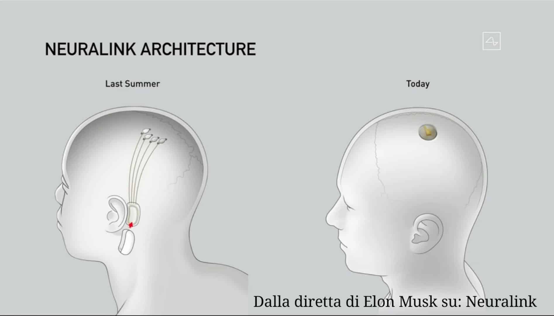 Neuralink, l’interfaccia uomo-macchina sempre più vicina