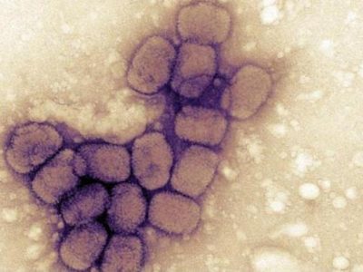 Un vaiolo dalle scimmie: “Monkeypox virus”. Preoccupazione in Europa, ma gli esperti rassicurano