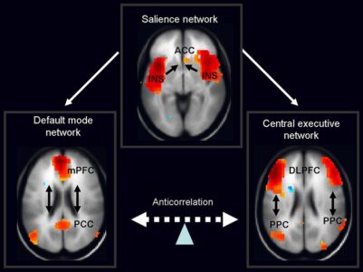 https://en.wikipedia.org/wiki/Salience_network